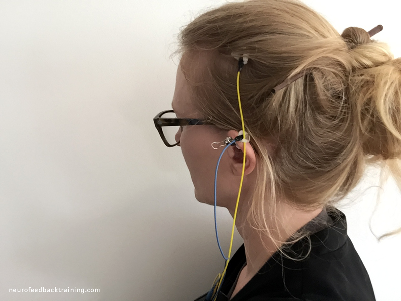 neurofeedback-eeg-sensor-placement-neuro-optimal-neurofeedback