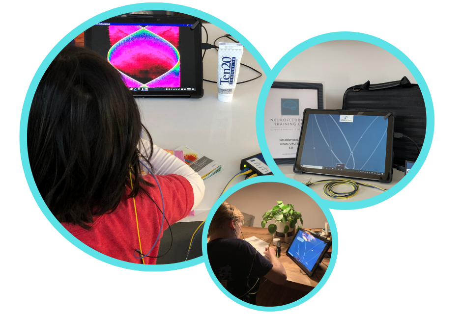 rent neuroptimal home neurofeedback-1