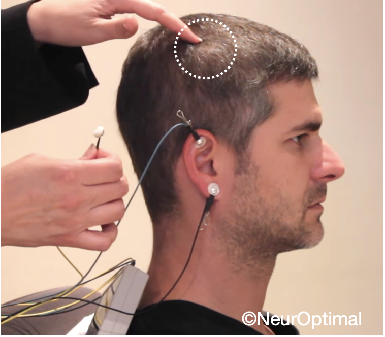 neurofeedback-eeg-sensor-placement-neuroptimal neurofeedback-eeg-sensor-placement-neuroptimal