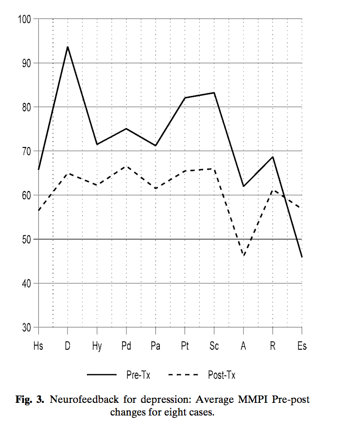 Neurofeedback For Depression Chart Research