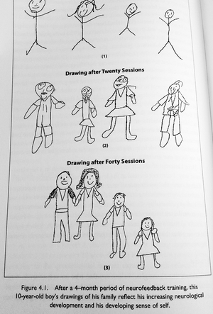 Neurofeedback Before After Childs Drawing